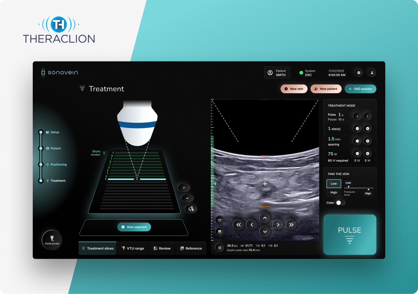 THERACLION / Sonovein